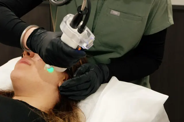 Hair Blanching at Skinholic Aesthetics & Laser, in the treatment room