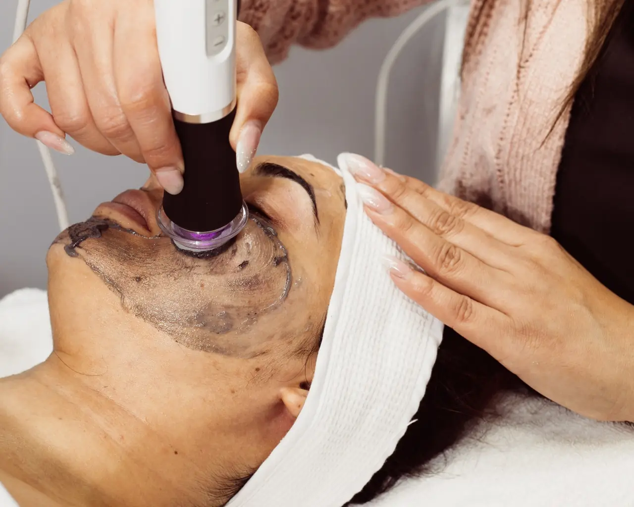 Skin Tightening at Skinholic Aesthetics & Laser
