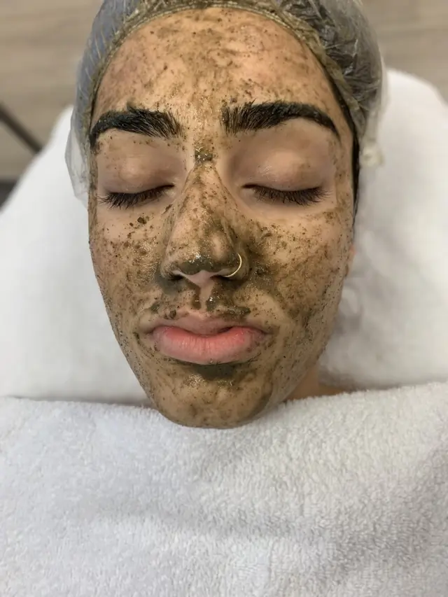 Apocalypsis Phyto-Peel at Skinholic Aesthetics & Laser, in the treatment room
