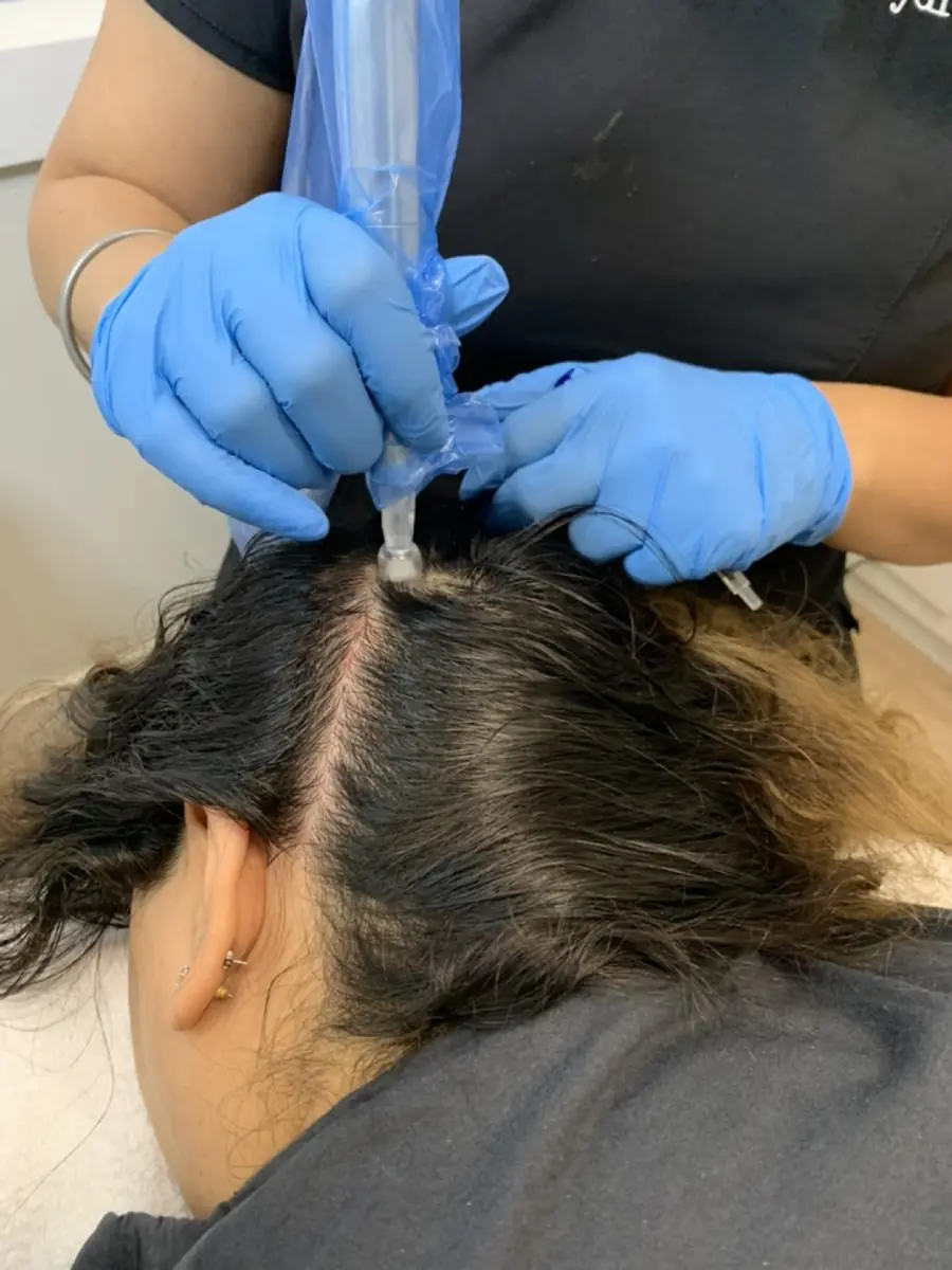 Korean Head Spa at Skinholic Aesthetics & Laser, consultation