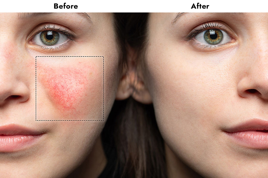 skin treatment for women