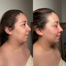 Hadado & Kobido Facial Sculpting Massage