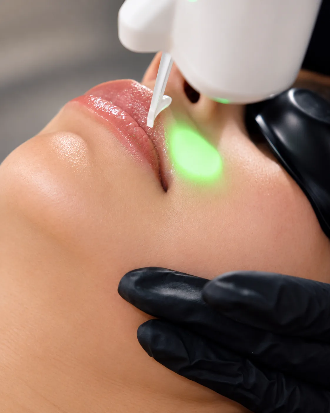 Titanium Face Lift at Skinholic Aesthetics & Laser, in the treatment room