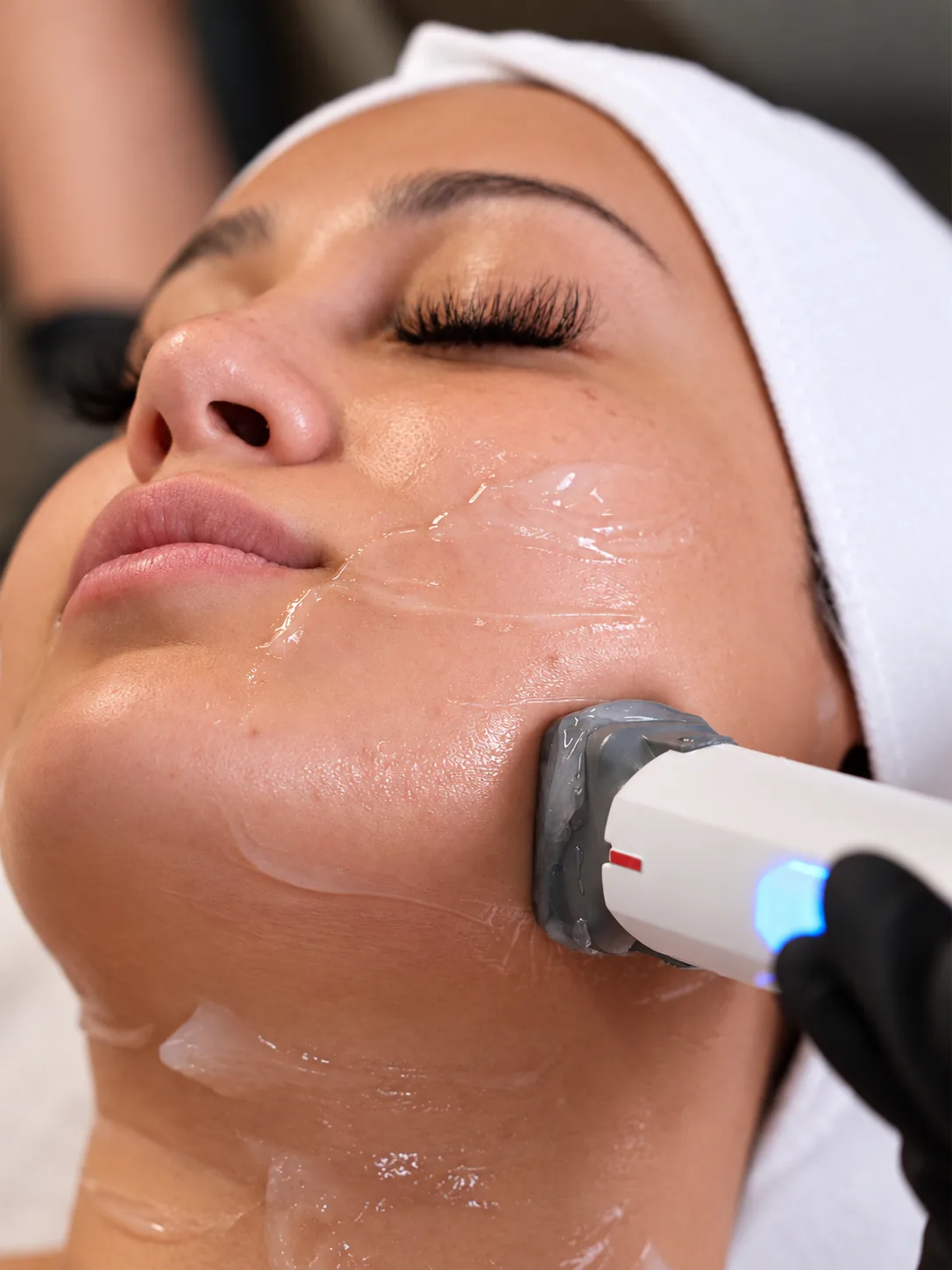 Non-Invasive Structural Skin Tightening at Skinholic Aesthetics & Laser, in the treatment room