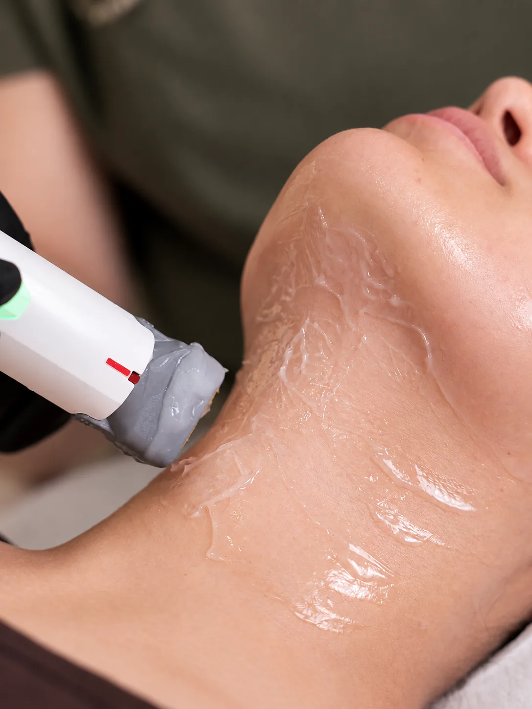 Non-Invasive Structural Skin Tightening at Skinholic Aesthetics & Laser, in the treatment room