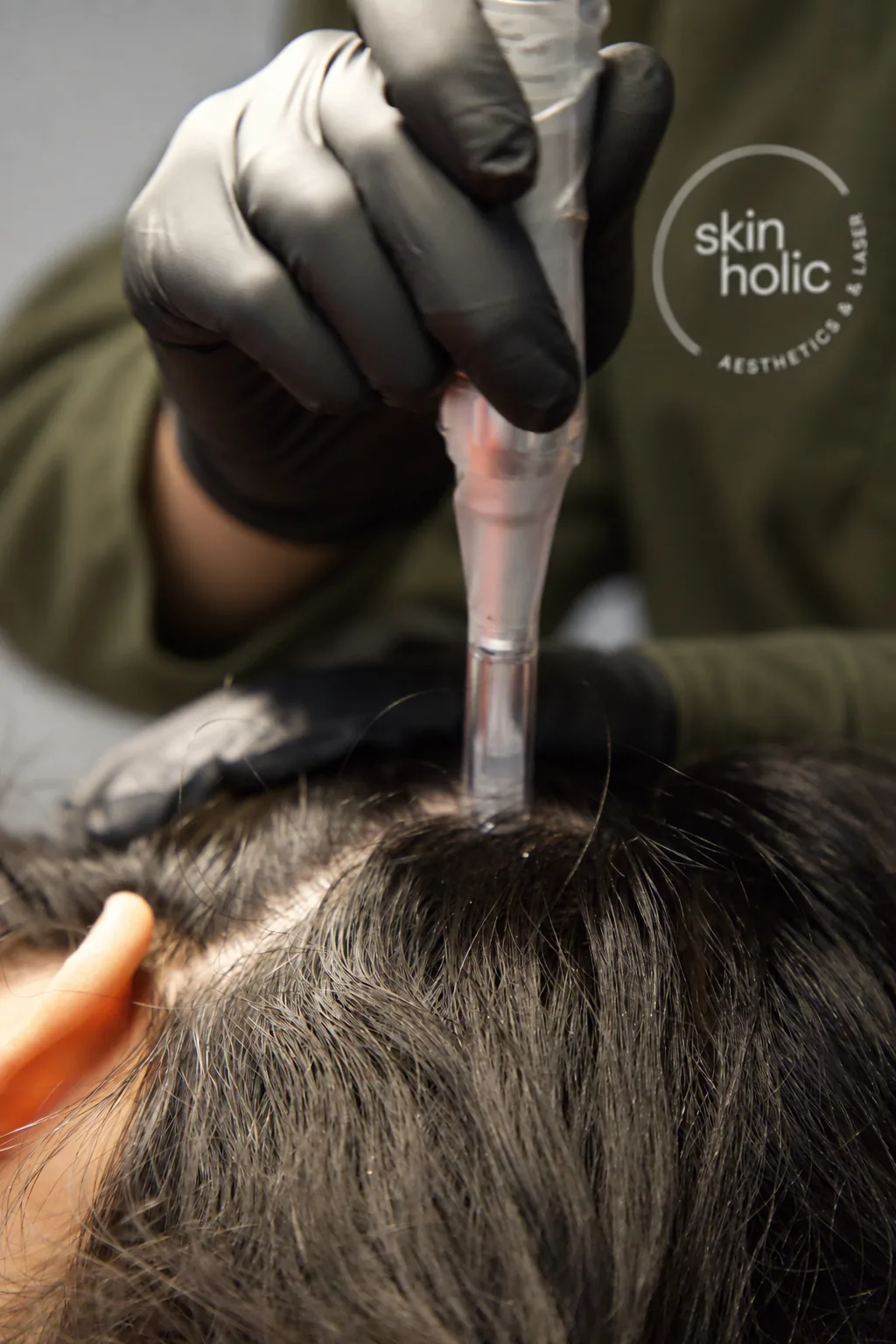 DERIVE Hair Wellness at Skinholic Aesthetics & Laser, in the treatment room