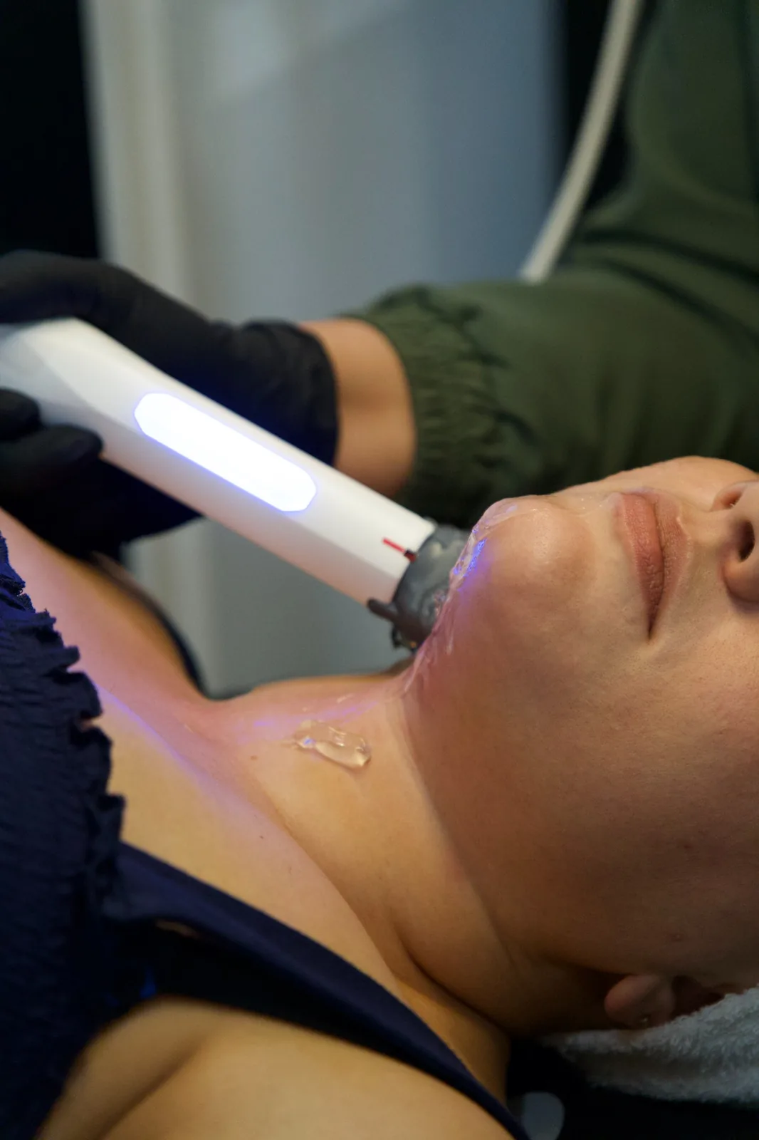 Non-Invasive Structural Skin Tightening at Skinholic Aesthetics & Laser, consultation